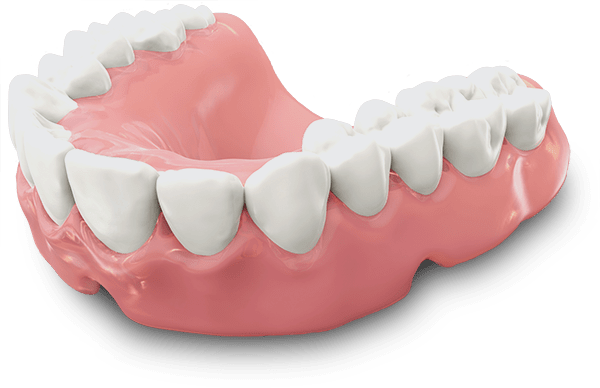 traditional full mouth dentures